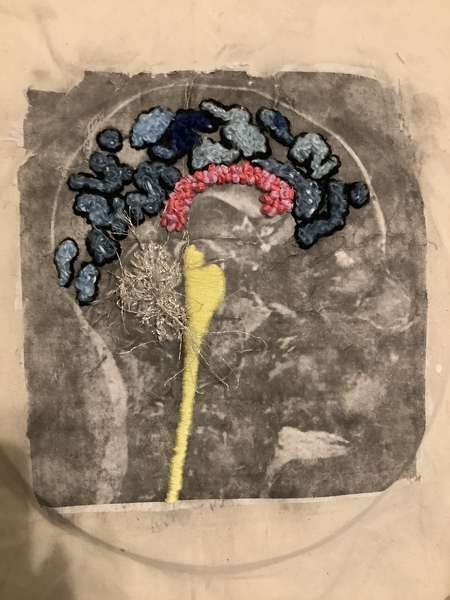 SEW this is my MRI 