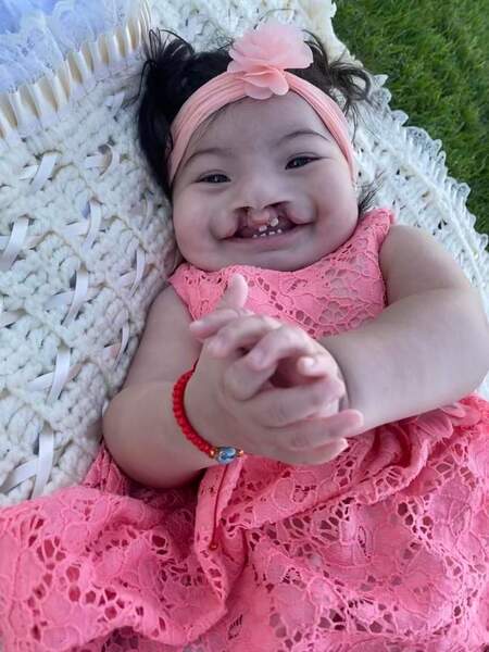 Thea 