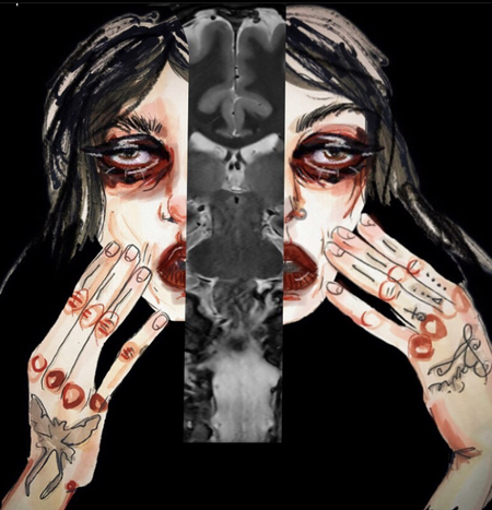 Pituitary Woman 