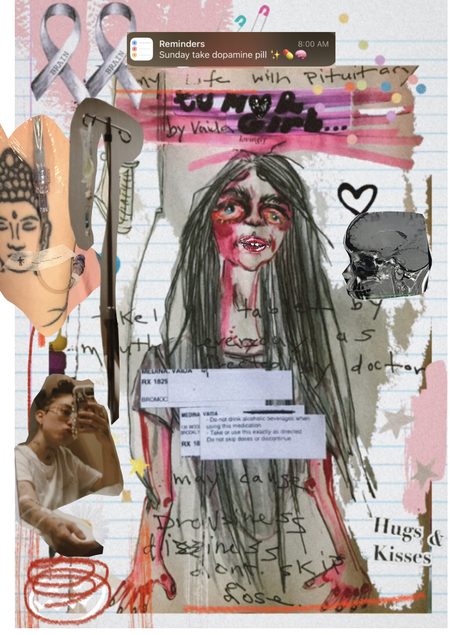 Tumor girl journal 