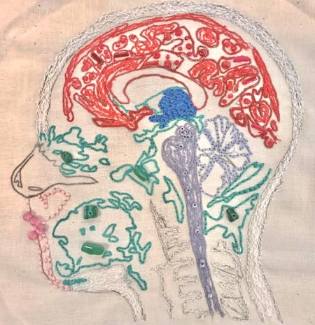 MRI HEAD/BRAIN SCAN IN STITCH EMBROIDERY FORM