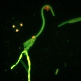 Entry image for Microscopic Whooping Crane