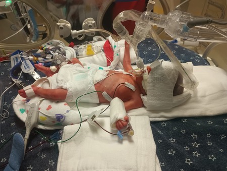 Entry image for Jaxson . Clicking this image will show a larger photo